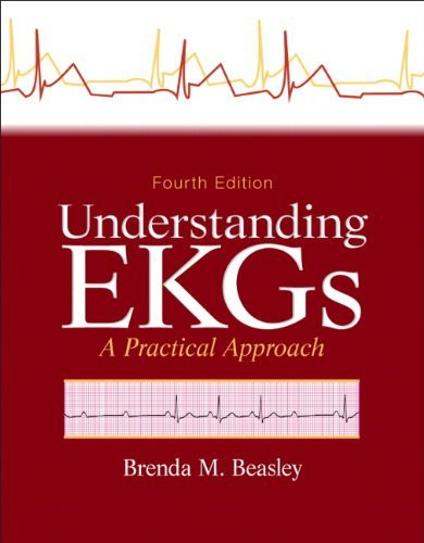 Understanding Ekgs