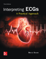 Interpreting ECGs