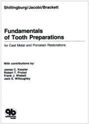 Fundamentals of Tooth Preparations for Cast Metal and Porcelain Restorations