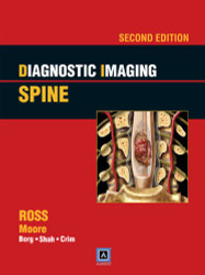 Diagnostic Imaging: Spine