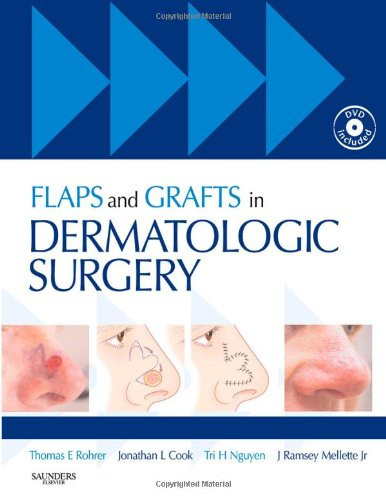 Flaps and Grafts in Dermatologic Surgery