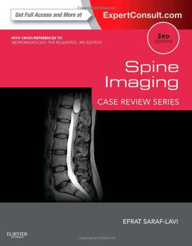 Spine Imaging