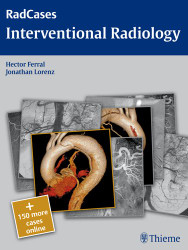 RadCases Q&A Interventional Radiology