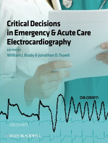 Electrocardiography in Emergency Acute and Critical Care