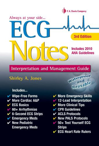 ECG Notes Interpretation and Management Guide