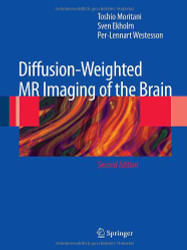 Diffusion-Weighted Mr Imaging of the Brain