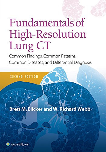 Fundamentals of High-Resolution Lung CT