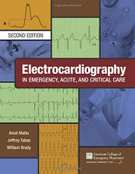 Electrocardiography in Emergency Acute and Critical Care