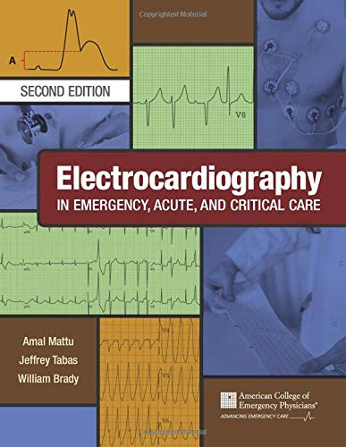 Electrocardiography in Emergency Acute and Critical Care