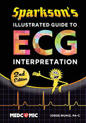 Sparkson's Illustrated Guide to ECG Interpretation