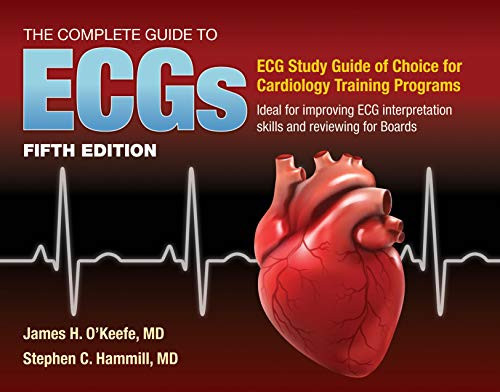Complete Guide to ECGs