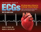 Complete Guide to ECGs