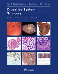 Digestive System Tumours (Medicine)