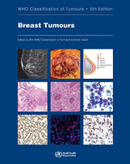 Breast Tumours WHO Classification of Tumours of the Breast