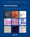 Breast Tumours WHO Classification of Tumours of the Breast