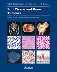 Soft Tissue and Bone Tumours (Medicine)