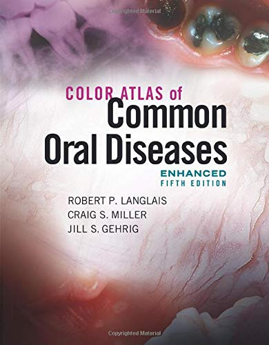 Color Atlas of Common Oral Diseases Enhanced Edition
