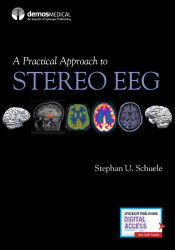Practical Approach to Stereo EEG