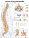 Human Spine Disorders Anatomical Chart