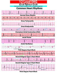 12 Lead EKG Pocket Card