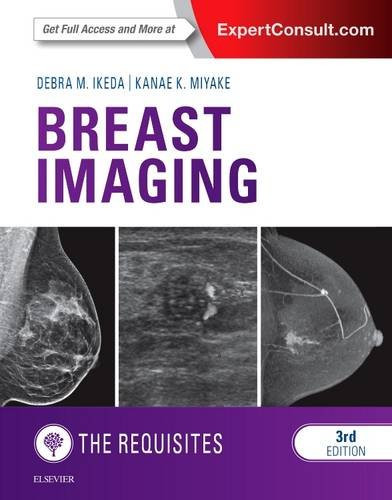 Breast Imaging: The Requisites (Requisites in Radiology)