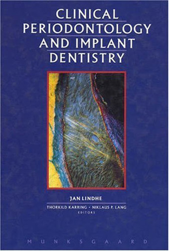 Lindhe's Clinical Periodontology and Implant Dentistry