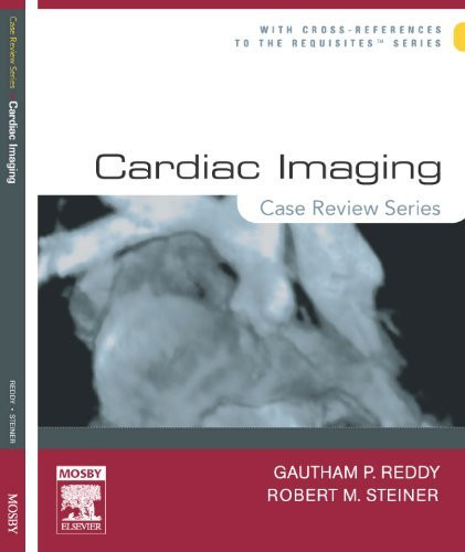 Cardiac Imaging