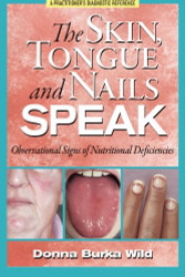 Skin Tongue and Nails Speak: Observational Signs of Nutritional Deficiencies