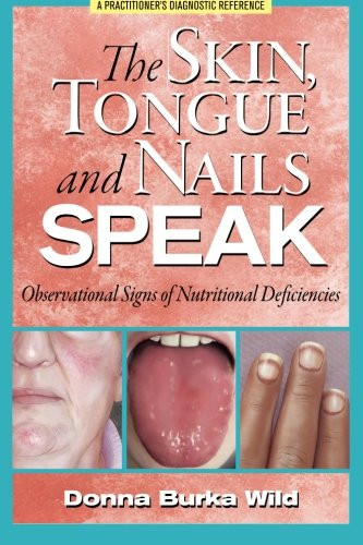 Skin Tongue and Nails Speak: Observational Signs of Nutritional Deficiencies