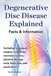 Degenerative Disc Disease Explained. Including Treatment