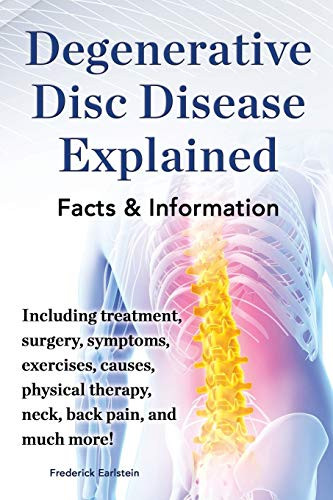 Degenerative Disc Disease Explained. Including Treatment