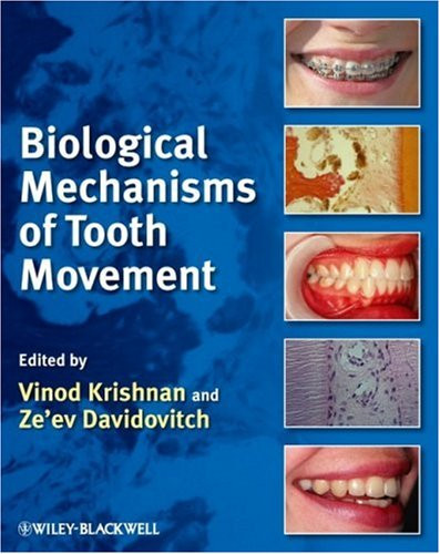 Biological Mechanisms of Tooth Movement Biological Mechanisms of Tooth Movement