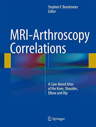 MRI-Arthroscopy Correlations