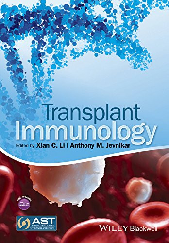 Transplant Immunology