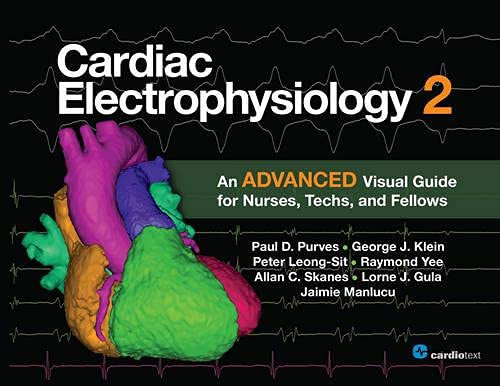 Cardiac Electrophysiology 2: An Advanced Visual Guide for Nurses
