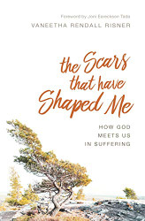 Scars That Have Shaped Me: How God Meets Us in Suffering