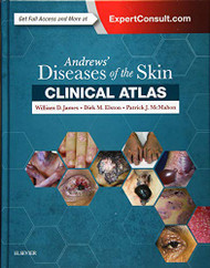 Andrews' Diseases of the Skin Clinical Atlas