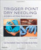 Trigger Point Dry Needling: An Evidence and Clinical-Based Approach