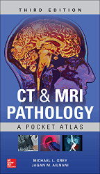CT & MRI Pathology: A Pocket Atlas