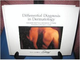 Differential Diagnosis in Dermatology