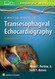 Practical Approach to Transesophageal Echocardiography