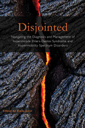 Disjointed Navigating the Diagnosis and Management of