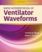 Rapid Interpretation of Ventilator Waveforms