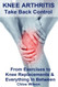 Knee Arthritis