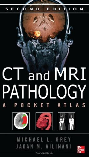 Ct And Mri Pathology