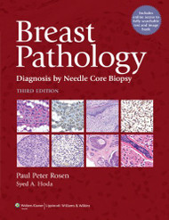 Breast Pathology
