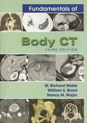 Fundamentals Of Body Ct
