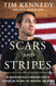 Scars and Stripes
