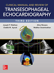 Clinical Manual and Review of Transesophageal Echocardiography