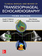 Clinical Manual and Review of Transesophageal Echocardiography